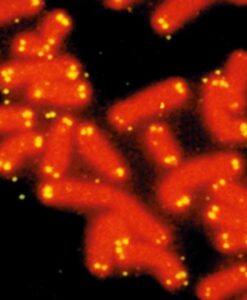 Fluorescence-stained chromosomes (red) on a microscope slide. Telomeres (yellow) sit at the ends of each chromosome. Photo courtesy of Dr. Robert Moyzis, UC Irvine, US Human Genome Program